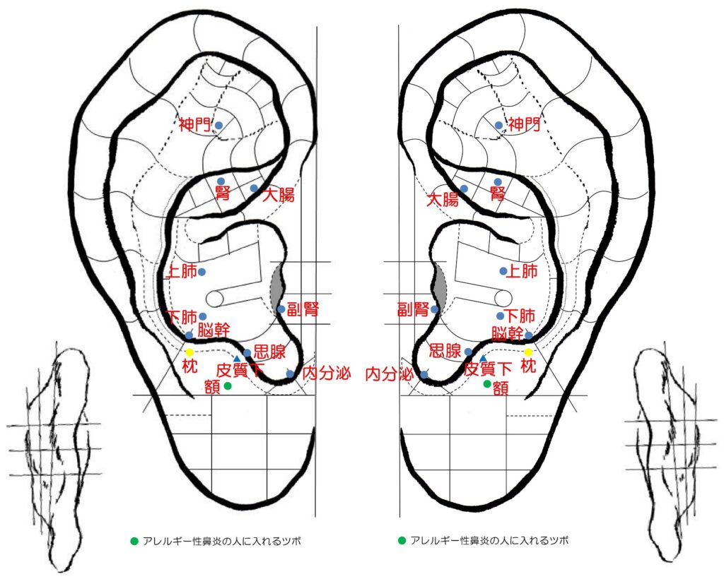 アレルギー体質改善